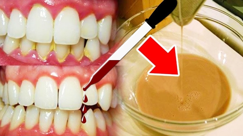 These 3 drops seal cavities