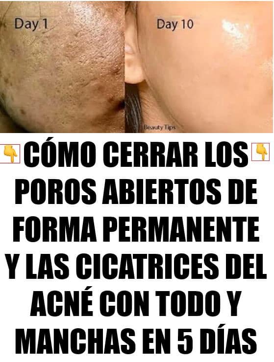 REPARA TU PIEL