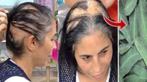 Plantas que te ayudarán a frenar la caída del cabello
