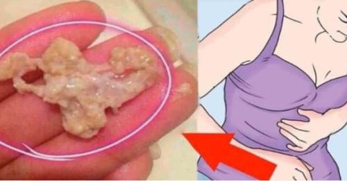 APRENDA CÓMO SACAR LAS INFECCIONES VAGINALES, HONGOS Y MALOS OLORES