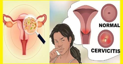 DESTRUYE CUALQUIER HONGO, BACTERIA, FLUJO O MAL OLOR QUE TENGAS