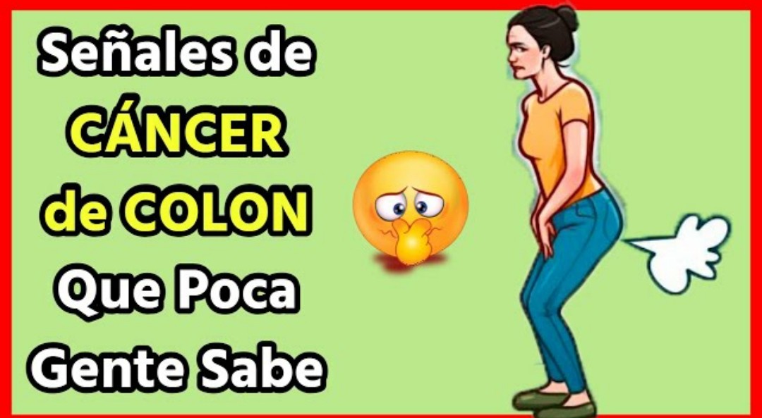 ¡OJO CON ESTO! 5 señales de cáncer de colon que mucha gente ignora.