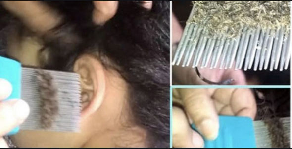 La niña llora del dolor en la cabeza, cuando su madre mira su cabello llamo a emergencias, no vas a creer 