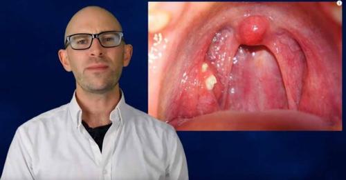 TE ENSEÑARÉ CÓMO DESHACERSE DE LAS INFECCIONES DE LA GARGANTA NATURALMENTE CON REMOLACHA