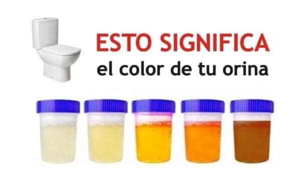 EL COLOR DE LA ORINA DICE TODO SOBRE TU SALUD ¡ESTO ES LO QUE SIGNIFICA SU COLOR Y QUE PODRÍA ANDAR MAL EN TU CUERPO