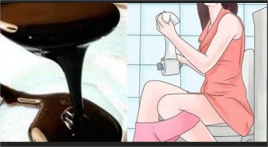 PURGANTE CASERO PARA BOTAR TODAS LAS HECES ACUMULADAS EN MENOS DE 1 HORA