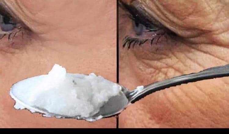 Elimina Arrugas Rapidamente