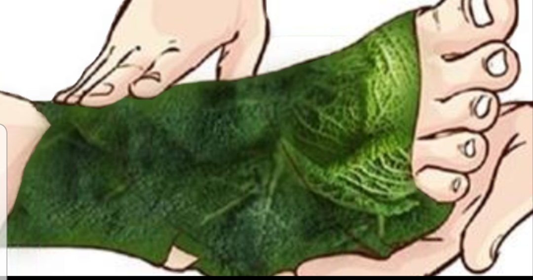 Cómo Aplicar Hojas De Repollo