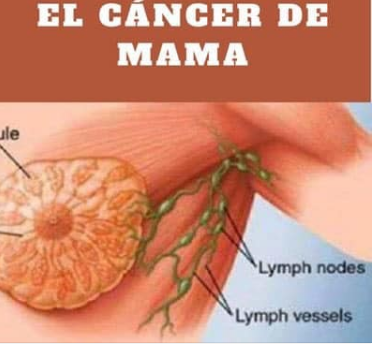 CIENTÍFICOS DESCUBREN QUE CAUSA EL CÁNCER DE MAMA Y LO BEBES A DIARIO