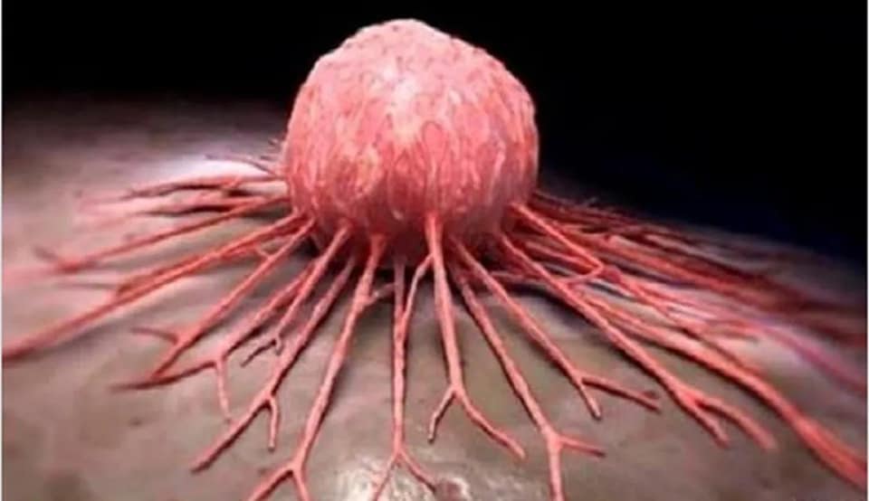 EL CÁNCER ES PRODUCIDO POR LA DEFICIENCIA DE ESTAS VITAMINAS, LOS DOCTORES LO SABEN, PERO LO TIENEN COMO UN NEGOCIO.