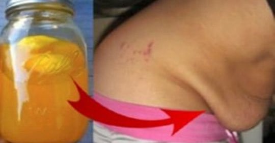 TÉ PARA DESINFLAMAR EL VIENTRE CAIDO