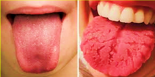 Atencion…El color de Tu lengua revela tu estado de Salud