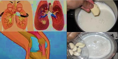 El Ajo en LEche son la Cura