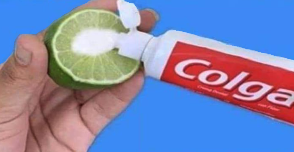 MEZCLA LIMON Y PASTA DE DIENTE UNA VEZ EN LA NOCHE Y ME LO AGRADECERA