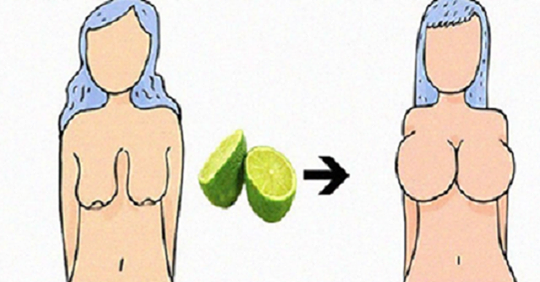 EL LIMÓN SE HA BURLADO DE LOS CIRUJANOS; LEVANTA TUS SENOS Y GLÚTEOS A PURO LIMÓN..