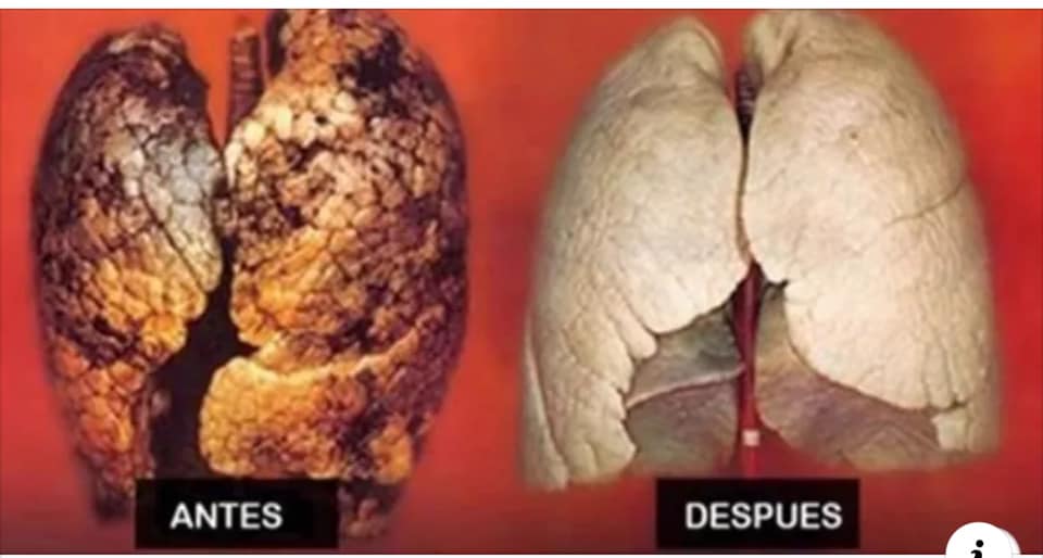 DEJA TU PULMONES COMO NUEVO