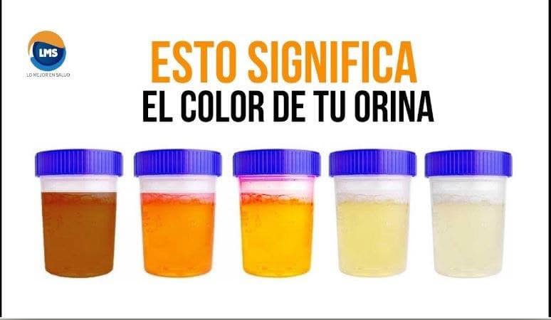 ¿Qué nos dice el color de la orina?