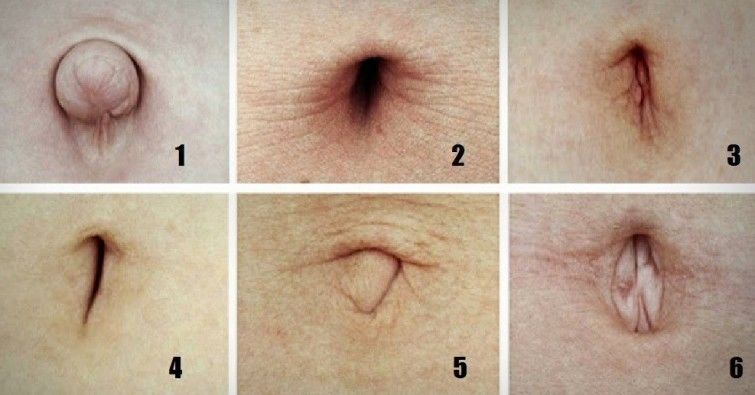 La forma del ombligo predice tus enfermedades