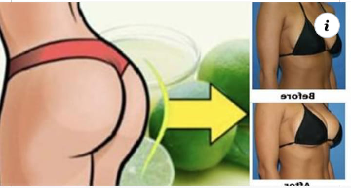 EL LIMÓN SE HA BURLADO DE LOS CIRUJANOS; LEVANTA TUS SENOS Y GLÚTEOS A PURO LIMÓN.