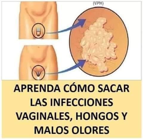 APRENDE A SACAR LA INFECCION