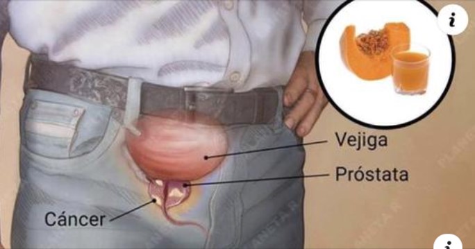 ASÍ FUE CÓMO SE CURÓ MI PRÓSTATA EN 7 DÍAS
