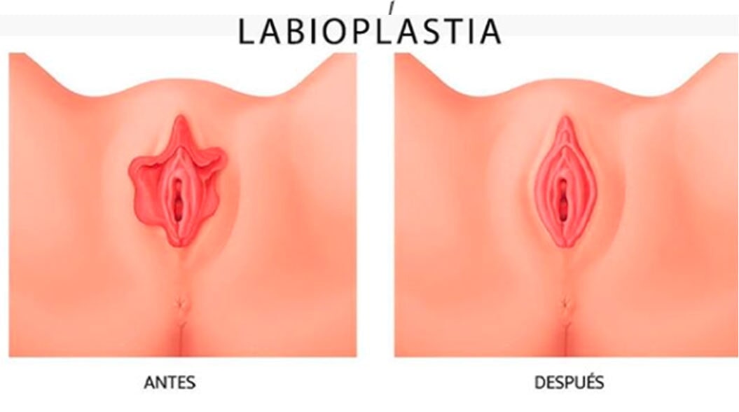 Trucos que toda mujer debe conocer para mantener la apariencia de su Vagina siempre rejuvenecida…..