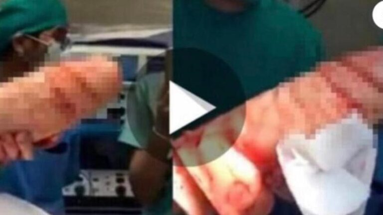 Chica Va Al Médico Con Un Terrible Dolor Abdominal. No podras creer lo que se sacan de su parte de atras
