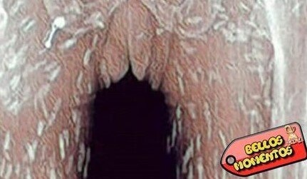LOS MÉDICOS DESCUBRIERON QUE SU CUERPO ESTABA REPLETO DE PARÁSITOS, Y LA CULPA FUE DE ESTE ALIMENTO QUE TODOS COMEMOS!!